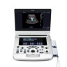 УЗИ аппарат Edan Acclarix AX3 - 700 627 руб.