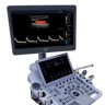 УЗИ аппарат Edan Acclarix LX9 - 2 242 006 руб.